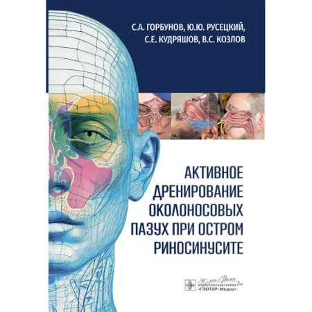 Медицинские энциклопедии и справочники, книга Активное дренирование околоносовых пазух при остром риносинусите