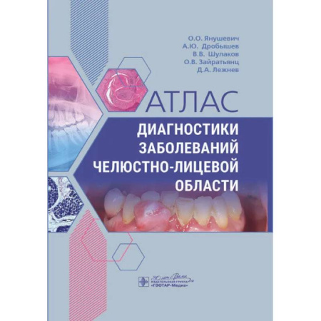 Специальная медицина, книга Атлас диагностики заболеваний челюстно-лицевой области