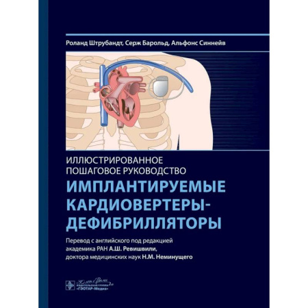 Студентам и аспирантам, книга Имплантируемые кардиовертеры-дефибрилляторы. Иллюстрированное пошаговое руководство