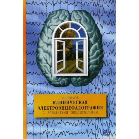 Диагностика. Методы и виды, книга Клиническая электроэнцефалография (с элементами эпилептологии)