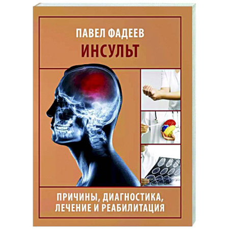 Специальная медицина, книга Инсульт. Причины, диагностика, лечение и реабилитация