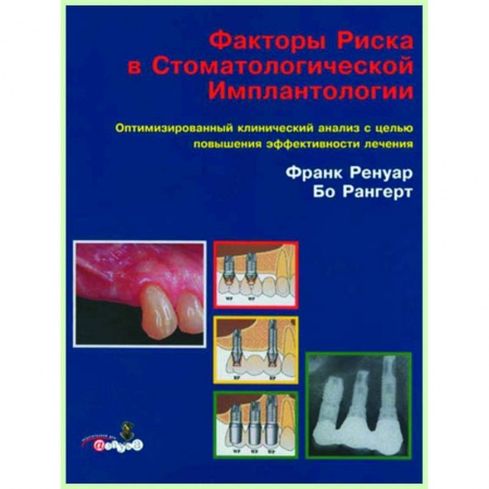 Специальная медицина, книга Факторы риска в стоматологической имплантологии.
