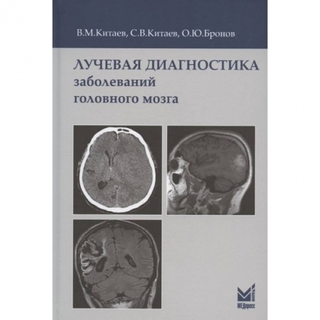 Диагностика. Методы и виды, книга Лучевая диагностика заболеваний головного мозга