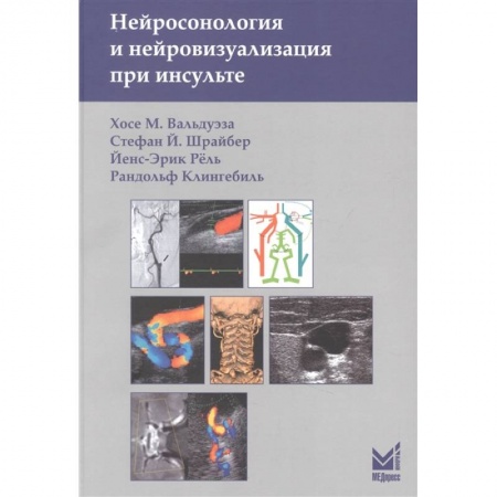 Специальная медицина, книга Нейросонология и нейровизуализация при инсульте