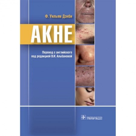 Диагностика. Методы и виды, книга Акне