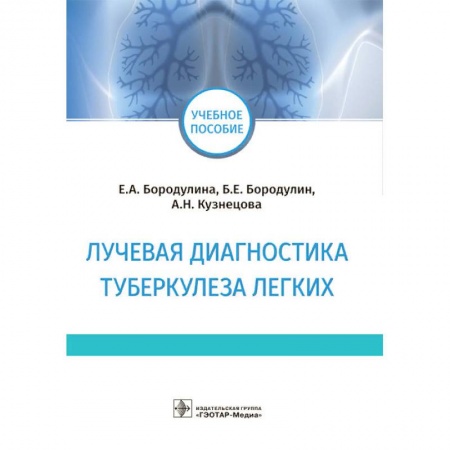 Специальная медицина, книга Лучевая диагностика туберкулеза легких