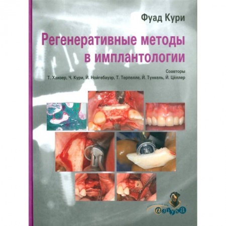 Специальная медицина, книга Регенеративные методы в имплантологии