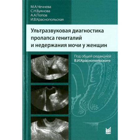 Диагностика. Методы и виды, книга Ультразвуковая диагностика пролапса гениталий и недержания мочи у женщин