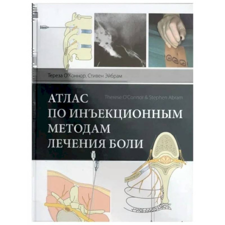 Специальная медицина, книга Атлас по инъекционным методам лечения боли