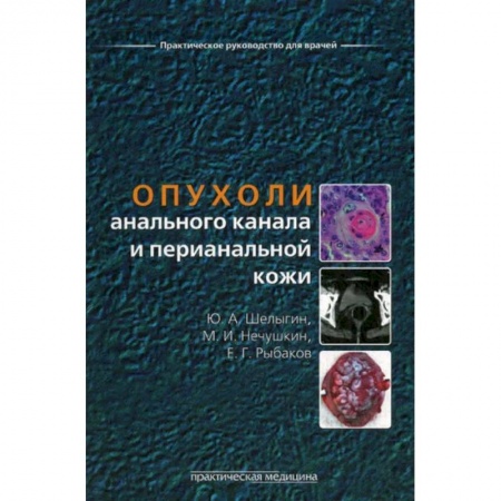 Специальная медицина, книга Опухоли анального канала и перианальной кожи