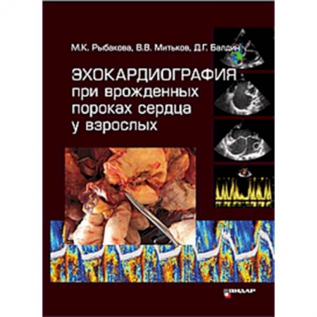 Специальная медицина, книга Эхокардиография при врожденных пороках сердца у взрослых