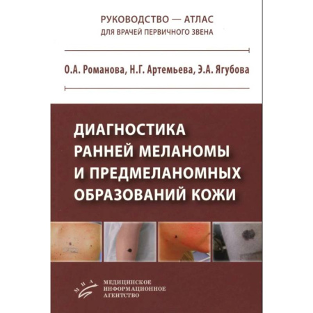 Студентам и аспирантам, книга Диагностика ранней меланомы и предмеланомных образований кожи: Руководство - атлас для врачей первичного звена