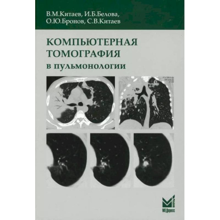 Специальная медицина, книга Компьютерная томография в пульмонологии