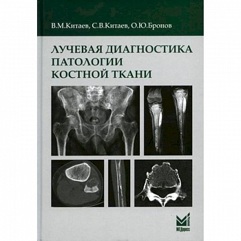 Лучевая диагностика патологии костной ткани Лучевая диагностика патологии костной ткани