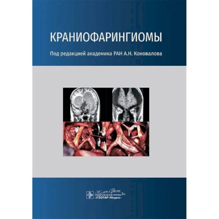 Специальная медицина, книга Краниофарингиомы