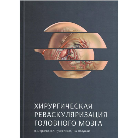 книга Хирургическая реваскуляризация головного мозга с доставкой по Франции Медицинские энциклопедии и справочники, книга Хирургическая реваскуляризация головного мозга