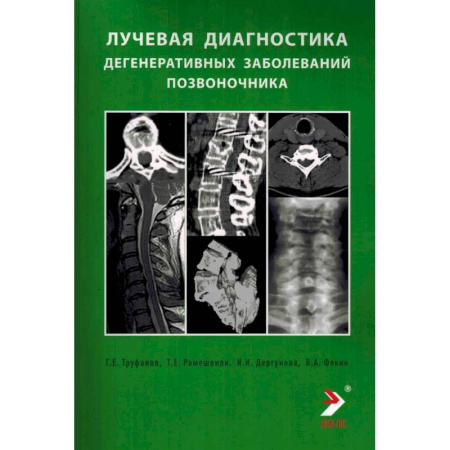 Диагностика. Методы и виды, книга Лучевая диагностика дегенеративных заболеваний позвоночника