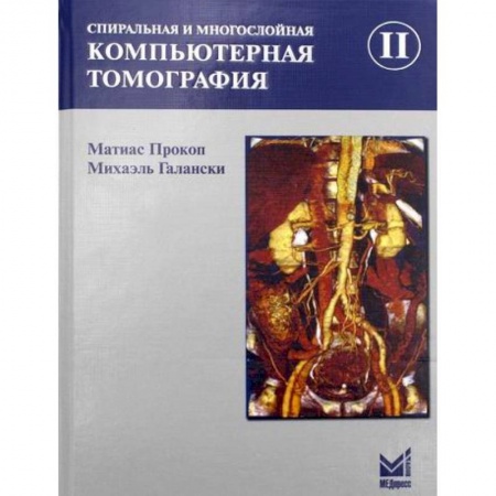 Диагностика. Методы и виды, книга Спиральная и многослойная компьютерная томография