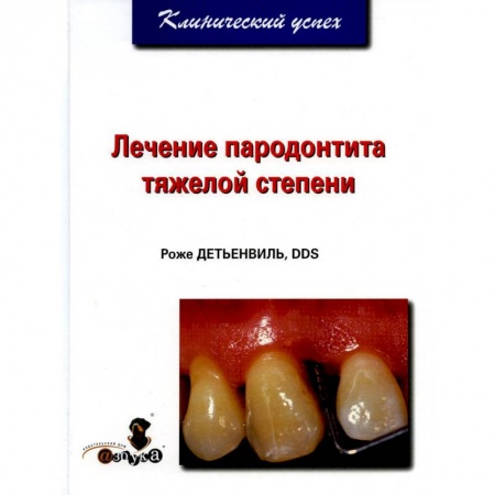 Специальная медицина, книга Лечение пародонтита тяжелой степени