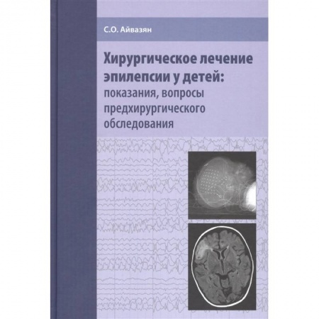 Специальная медицина, книга Хирургическое лечение эпилепсии у детей: показания, вопросы предхирургического обследования