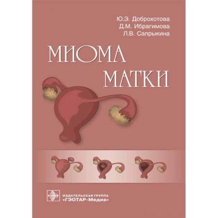 Медицинские энциклопедии и справочники, книга Миома матки