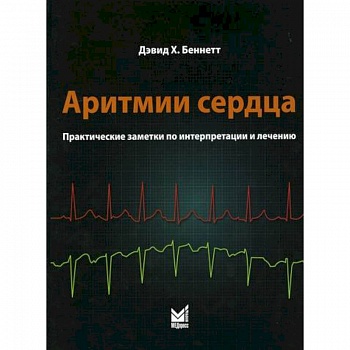 Аритмии сердца Аритмии сердца