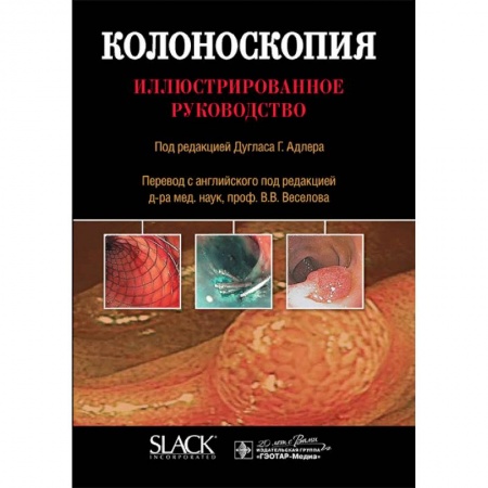 Специальная медицина, книга Колоноскопия. Иллюстрированное руководство