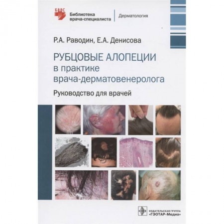 Специальная медицина, книга Рубцовые алопеции в практике врача-дерматовенеролога. Руководство для врачей