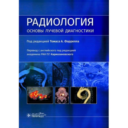 Специальная медицина, книга Радиология. Основы лучевой диагностики