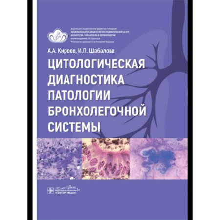 Медицинские энциклопедии и справочники, книга Цитологическая диагностика патологии бронхолегочной системы