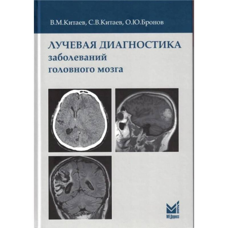 Специальная медицина, книга Лучевая диагностика заболеваний головного мозга