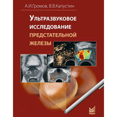 Диагностика. Методы и виды, книга Ультразвуковое исследование предстательной железы
