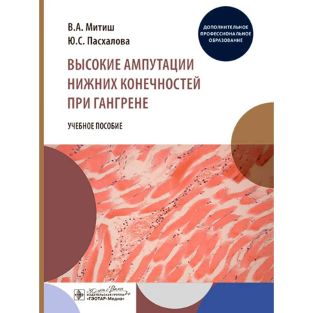 Медицинские энциклопедии и справочники, книга Высокие ампутации нижних конечностей при гангрене