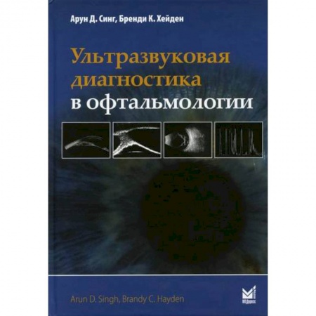 Специальная медицина, книга Ультразвуковая диагностика в офтальмологии