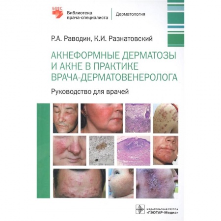 Студентам и аспирантам, книга Акнеформные дерматозы и акне в практике врача-дерматовенеролога: руководство для врачей