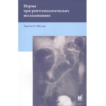 Фармакология. Рецептура. Токсикология, книга Норма при рентгенологических исследованиях . Мёллер Т.Б.
