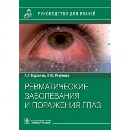 Книги, книга Ревматические заболевания и поражения глаз