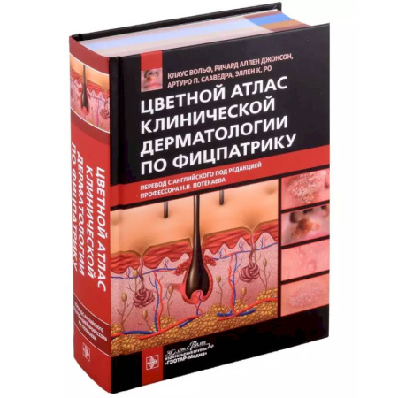 Специальная медицина, книга Цветной атлас клинической дерматологии по Фицпатрику