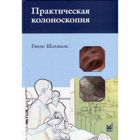 Медицинские энциклопедии и справочники, книга Практическая колоноскопия. Методика, рекомендации, советы и приемы