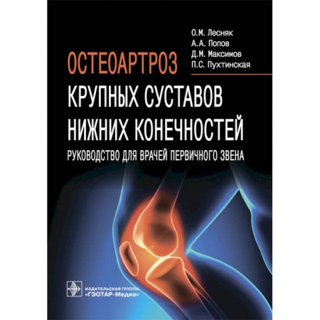 Книги, книга Остеоартроз крупных суставов нижних конечностей