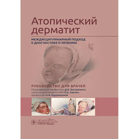 Специальная медицина, книга Атопический дерматит. Междисциплинарный подход к диагностике и лечению: руководство для врачей